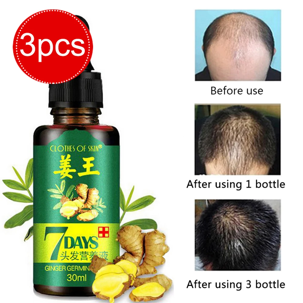 3 шт. сывороточная эссенция для роста волос женщин и мужчин защита от выпадения