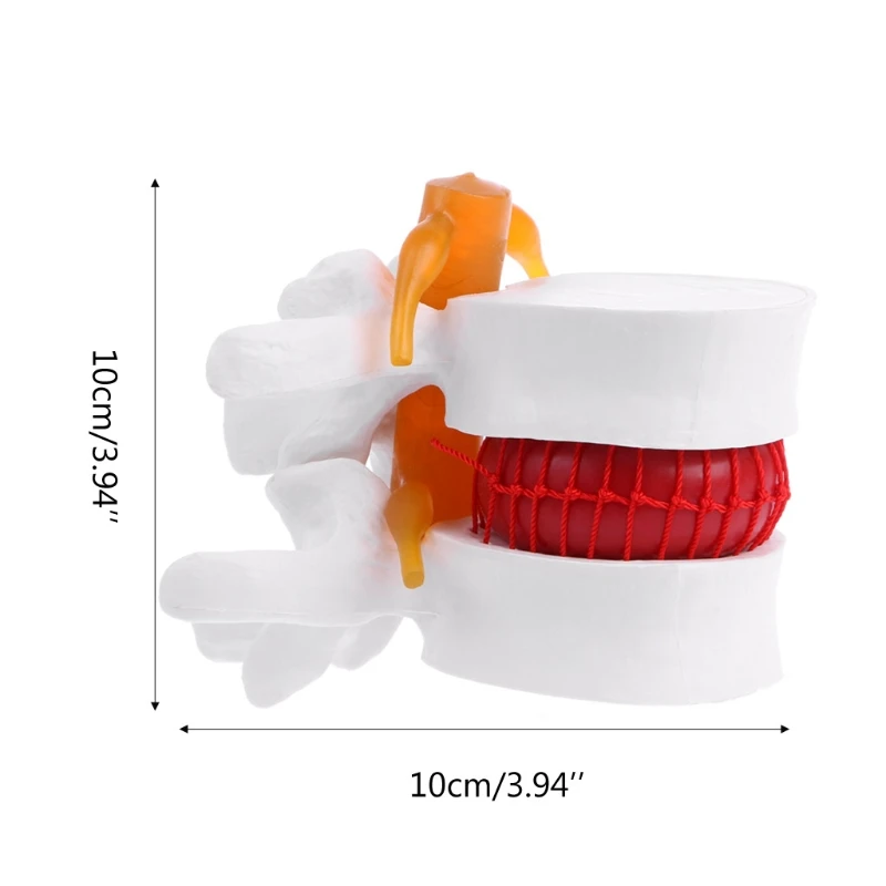 

Human Anatomical Lumbar Disc Herniation Model Medical Learn Aid Anatomy Instrume