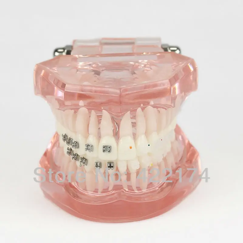 Бесплатная доставка полуметаллическая металлическая модель ортодонтики