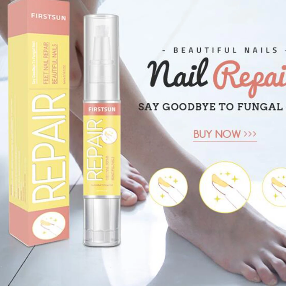 Китайский медицинский травяной грибок для ногтей средство лечения грибка Уход