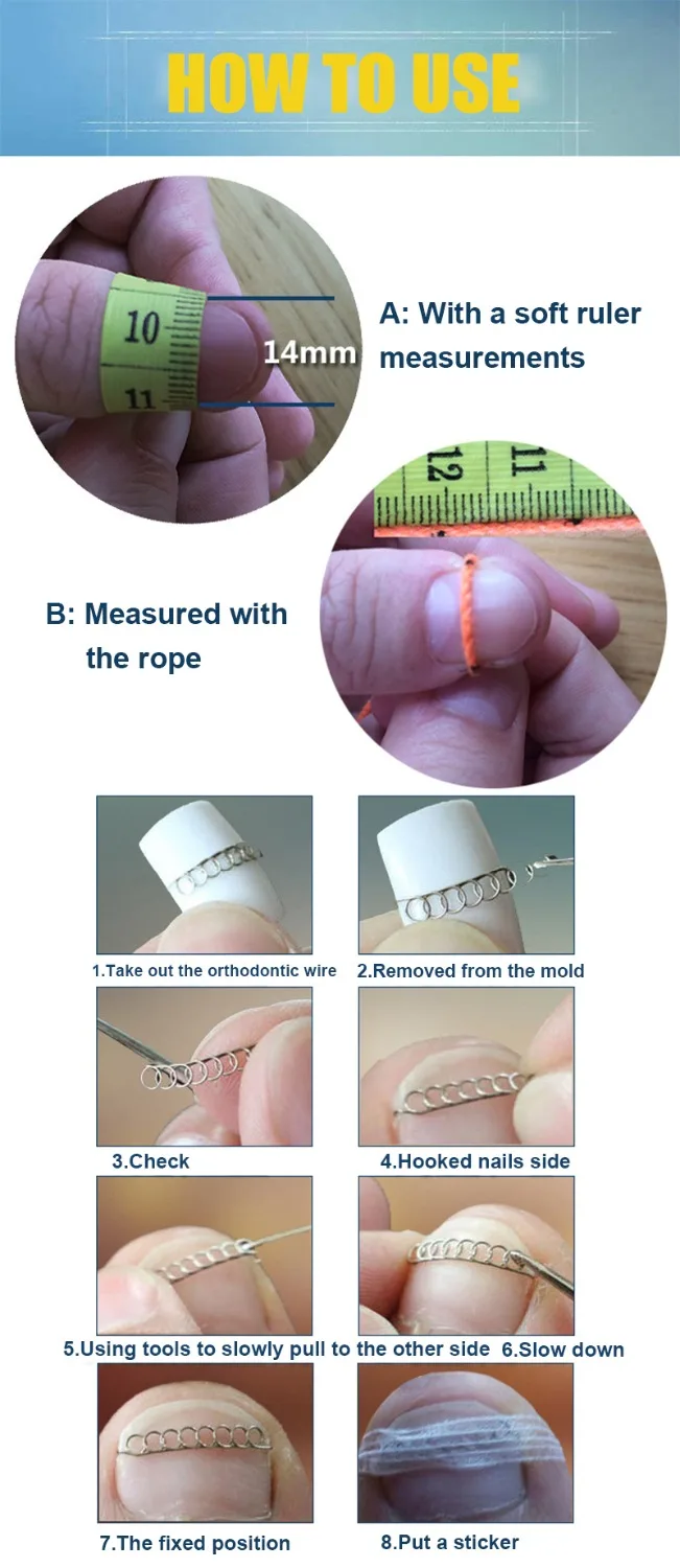 Ingrown Toenail Pedicure Tool Straightening Clip Toenails Correction Elastic Patches Treatment Foot Nail Care | Красота и здоровье