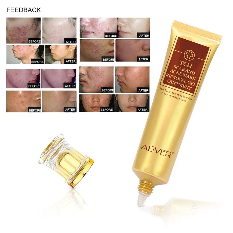 30g TCM SCAR AND ACNE MARK REMOVAL GEL Cream Acne Scar Bodysuits Repairing Gel And Anti-inflammatory | Красота и здоровье