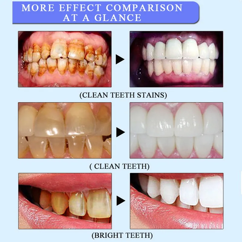 Manooby Новое поступление отбеливающая ручка для зубов гигиена полости рта