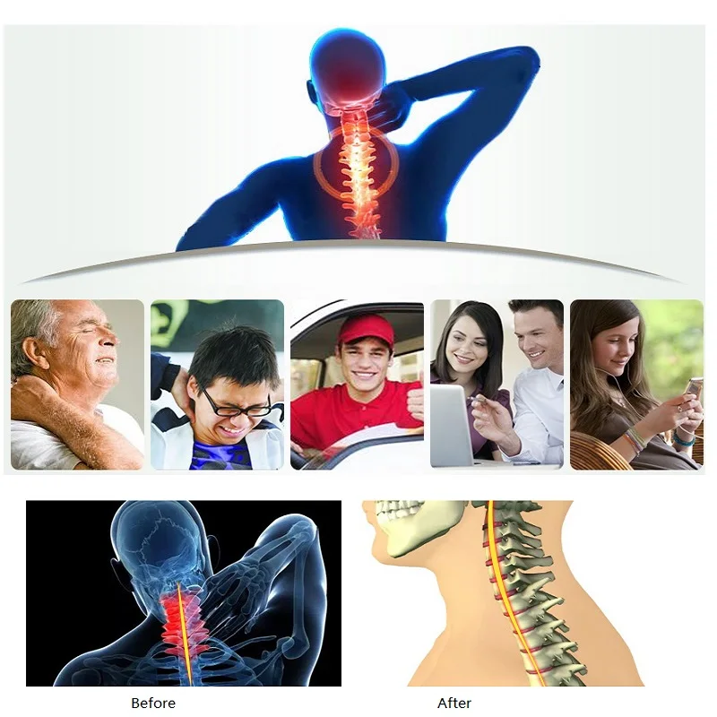 Устройство для растяжения шеи поясом Cervical Traction Belt Device Neck Stretcher Chiropractic Posture Corrector Head Back Health Relaxation