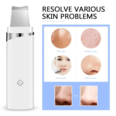 Ультразвуковой очиститель пор K_SKIN KD8023 для удаления черных точек и