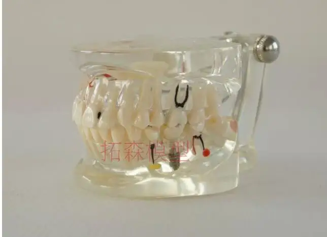 

Dental material Removable pathology Dental model free shipping