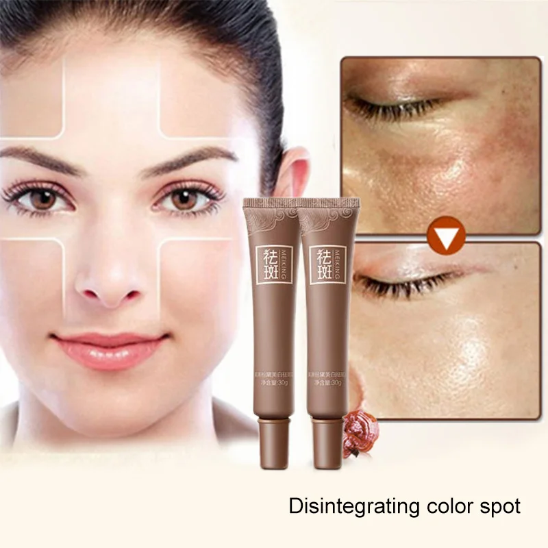 Уход за кожей возраст пятна меласмы удаление веснушек крем для лица Отбеливание