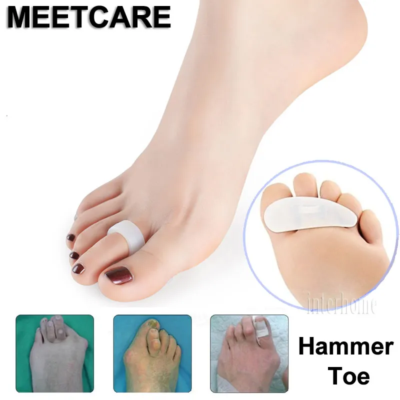 Ортопедический молоток Meetcare для пальцев ног вальгусная деформация при