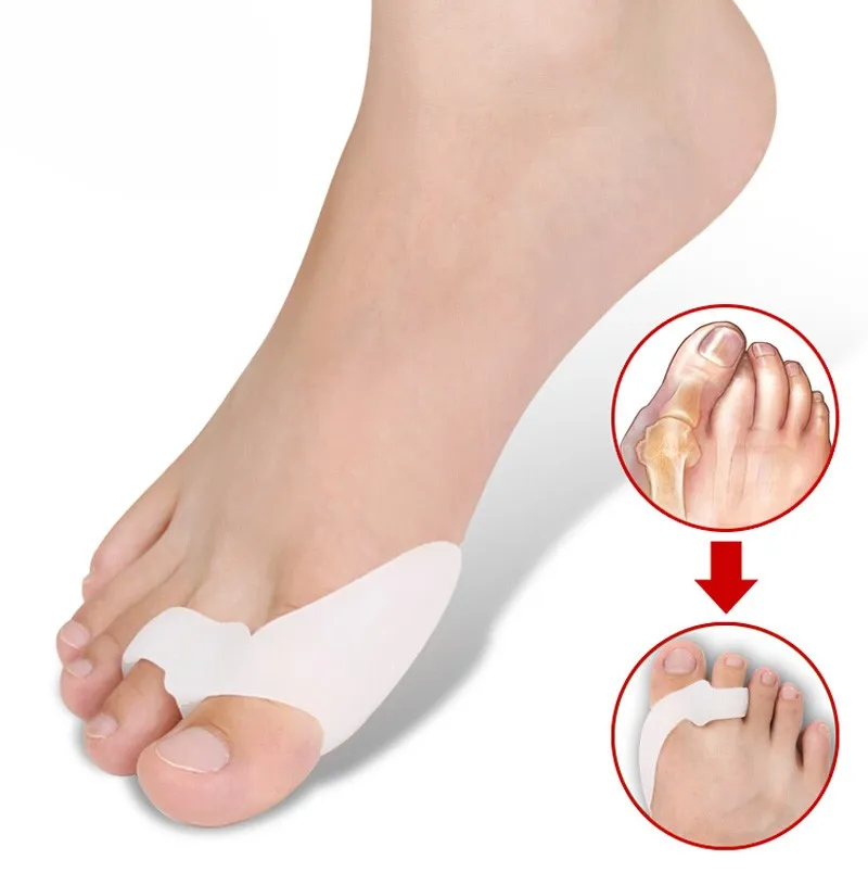 1 пара разделитель для пальцев ног при вальгусной деформации|foot care tool|care toolhallux valgus