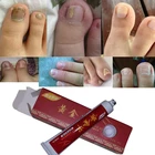Китайская травяная мазь для лечения грибка ногтей