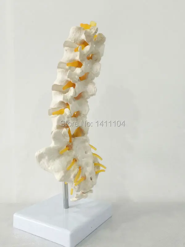 Бесплатная доставка и 5 поясничных крестцовых позвонков с креплением к нервам