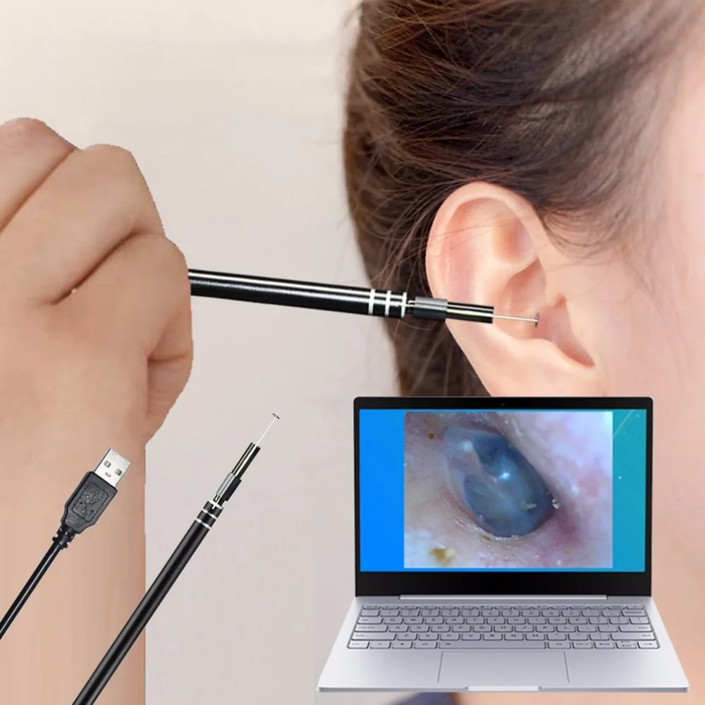 

USB / Type-C инструмент для чистки ушей HD визуальная ухочистка многофункциональная ухочистка с мини-камерой уход за ушами внутриушной эндоскоп ...