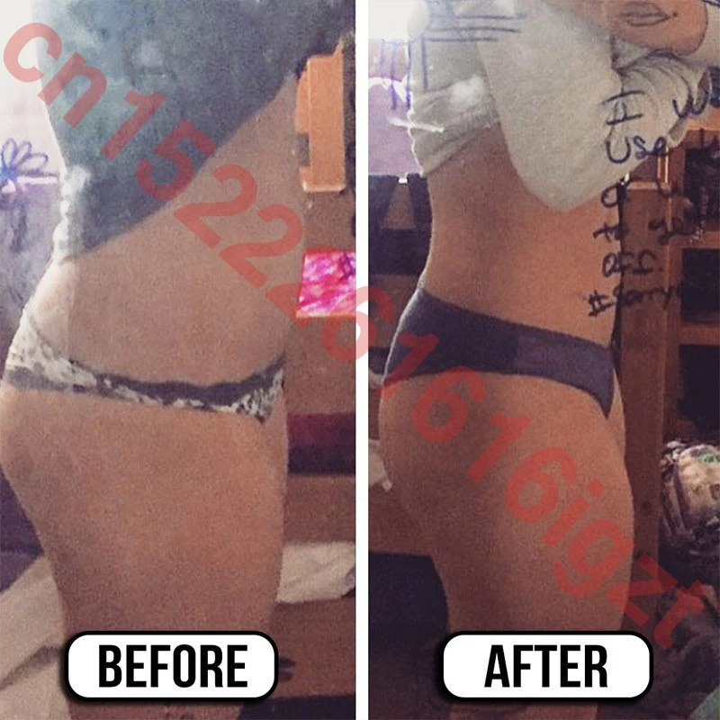 Крем для похудения и удаления целлюлита крем потери веса эффективный