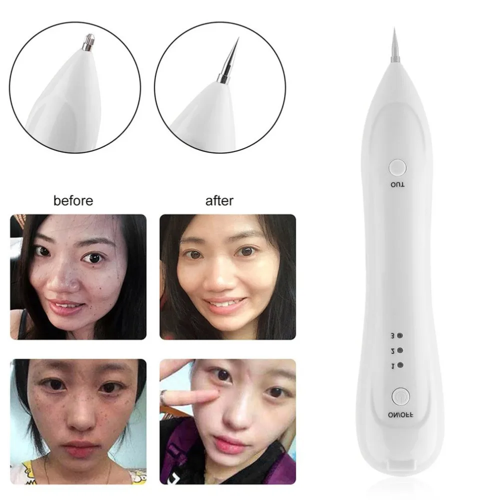 2017 Портативная Лазерная Веснушка точка моль темное пятно машинка карандаш для