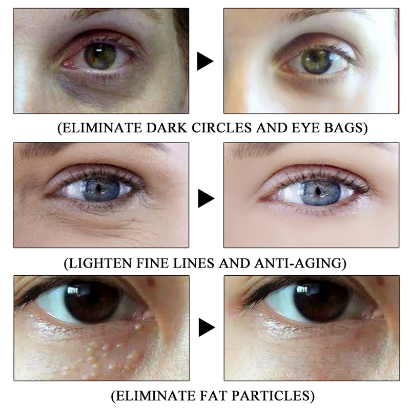 ROREC коллаж против старения Сыворотка для глаз Гиалуроновая кислота крем