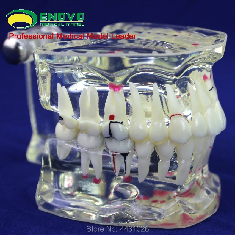 

ENOVO Oral and adult dental model cavity department communication