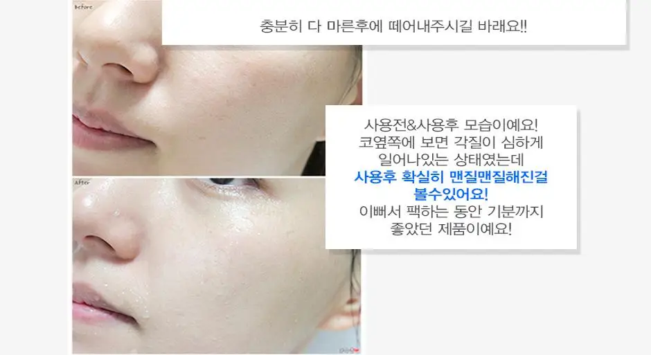 PUREDERM Galaxy отшелушивающая маска 5 шт. для лица поры усадка удаление угрей