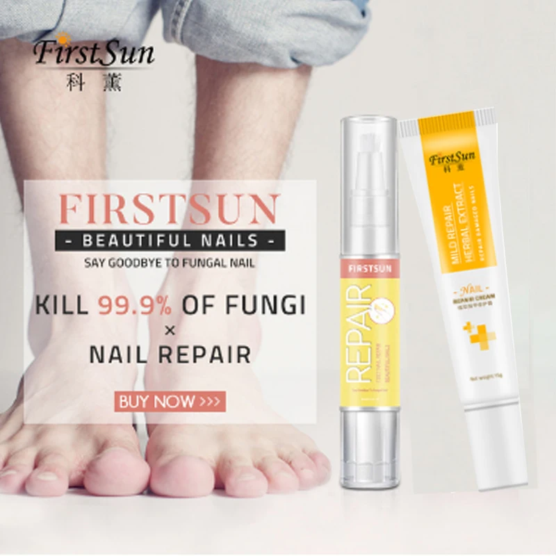 Firstsun пальца ноги анти-грибок ногтей инфекции лечение травяной крем онихомикоз