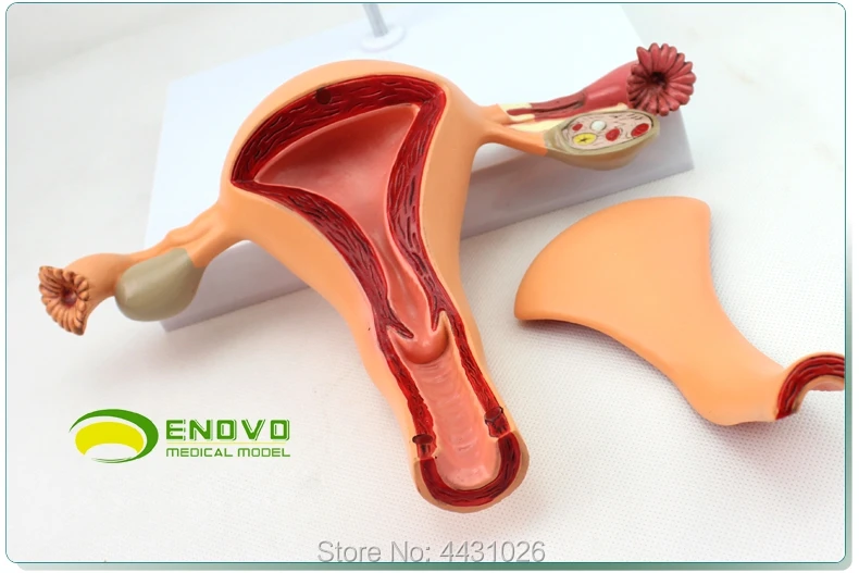 ENOVO Model of obstetrics and gynecology of reproductive organs in female reproductive organs in medical women