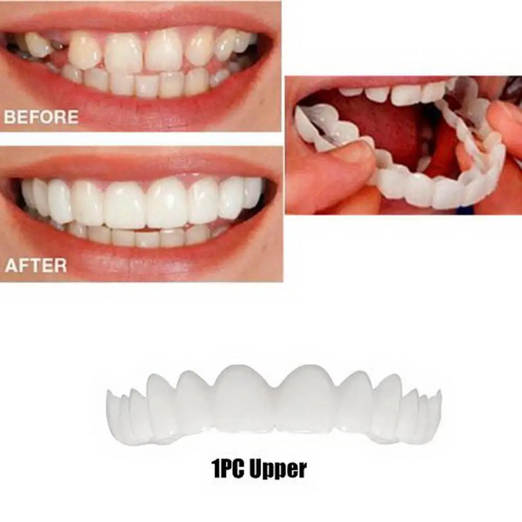 Отбеливание идеальный крой Верхняя Нижняя зубы + нижняя часть зубов взрослых