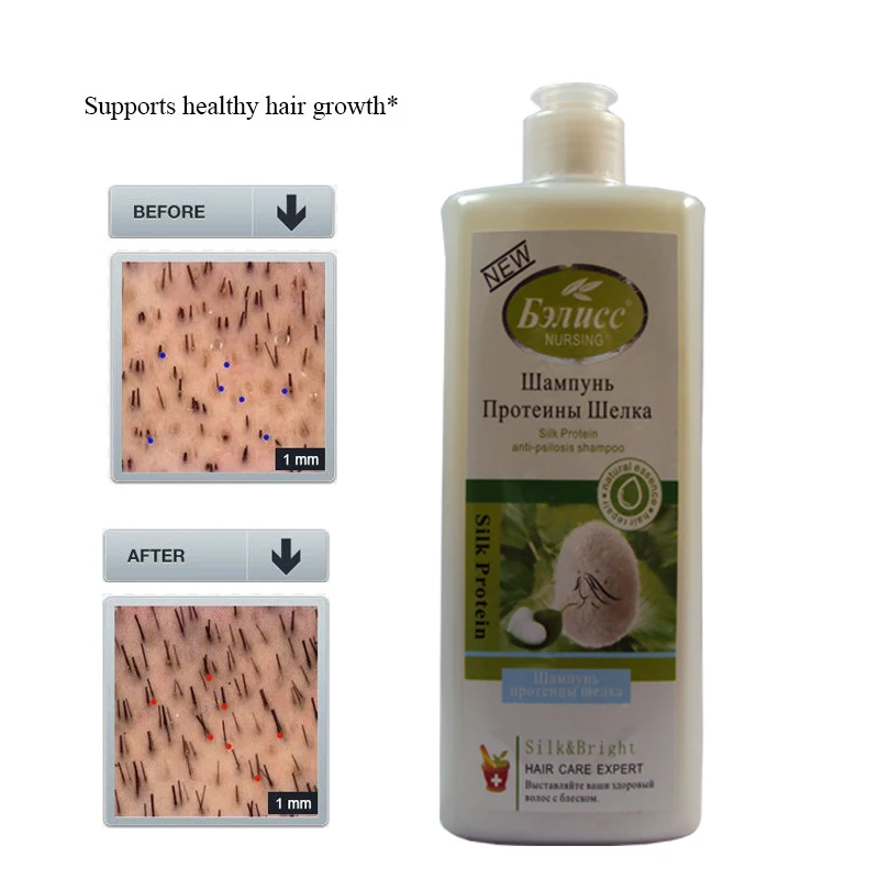 

Anti Loss Hair Shampoo for Hair Growth and Prevents Premature Thinning Hair Care for Men and Women 500g Free Shipping