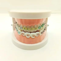 dental orthodontic treatment model with ortho metal ceramic bracket arch wire buccal tube ligature ties