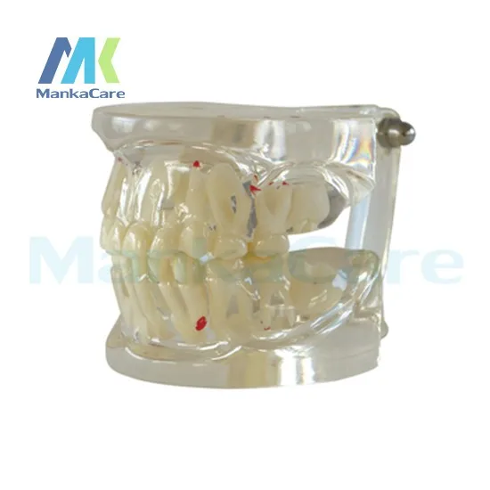 Manka Care-молочные зубы переменная модель искусственная с реставрационным мостом