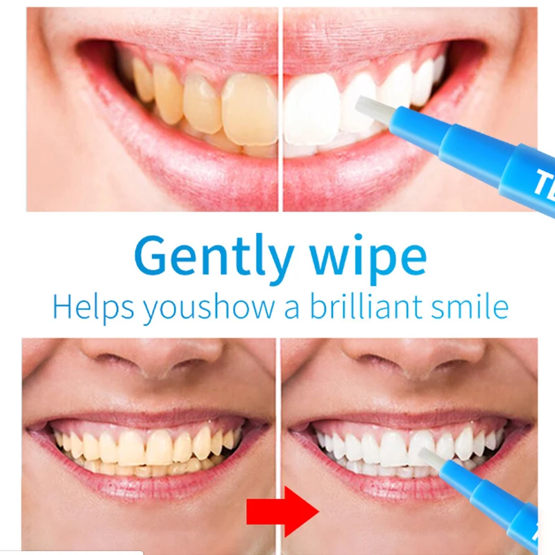 Ручка для отбеливания зубов LANBENA сыворотка устранения пятен от зубного налета