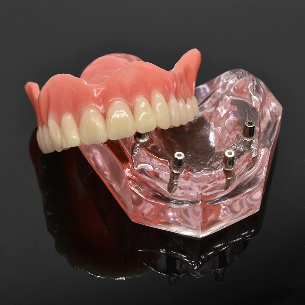Модель зубного протеза съемная внутренняя модель нижних зубов Mandibular с
