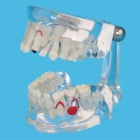 deciduous permanent alternate model child tooth development model free shipping