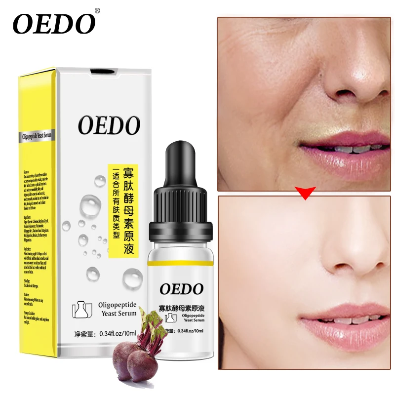 Oligopeptide дрожжи Prime супер морщин анти старения отбеливающая эссенция увлажняющий с