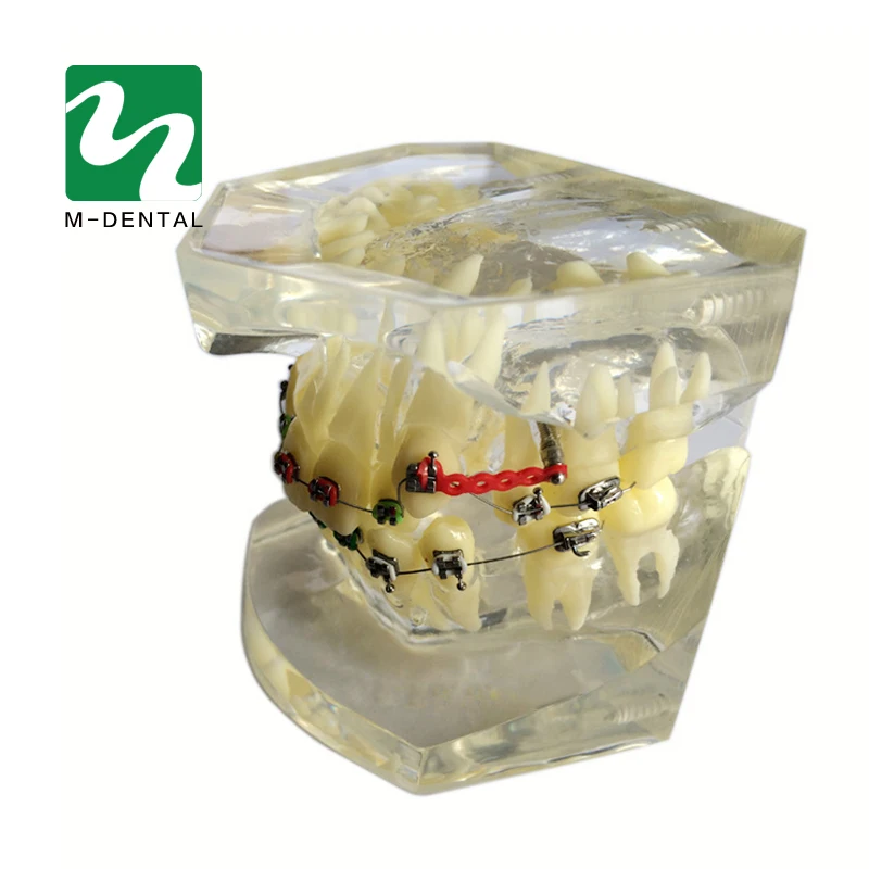 1 шт. Стоматологическая Ортодонтическая модель для обучения прозрачная с