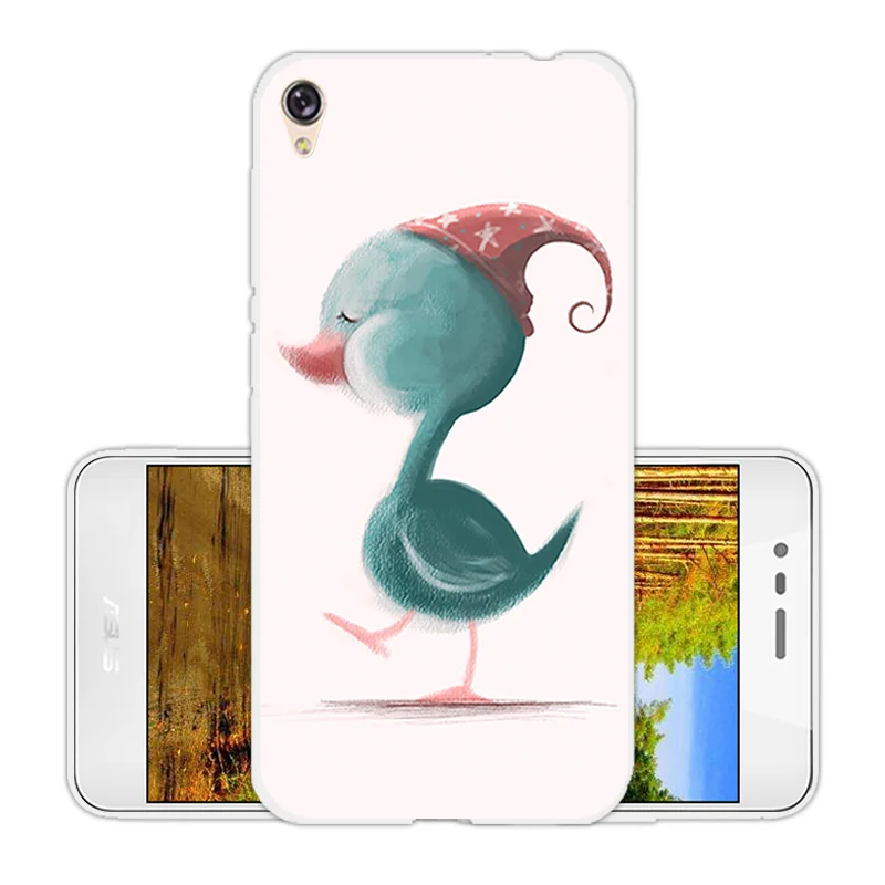 for Asus Zenfone live ZB501KL Luxury Soft Silicone Star Cover Cases Live Coque zb510 Funda |