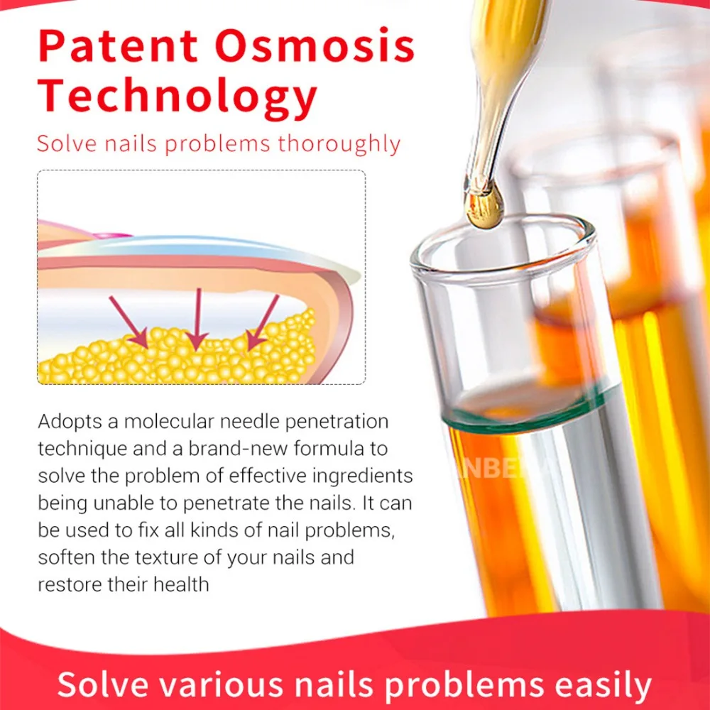 3 шт. высокое качество защита для ногтей крем ухода за кожей грибок лечение трав