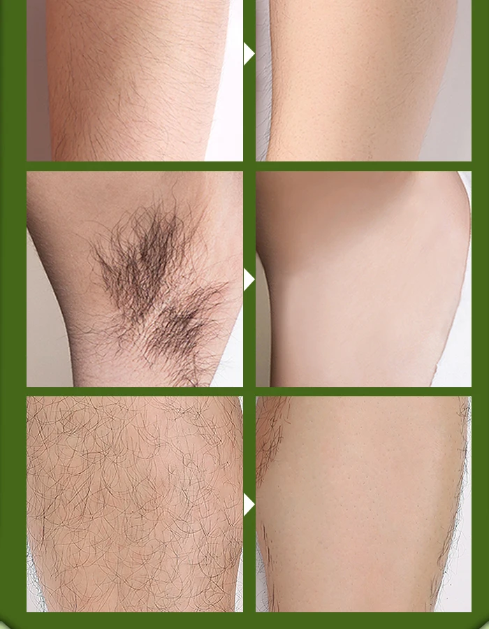 Крем для удаления волос в области рук и ног 40 г| |