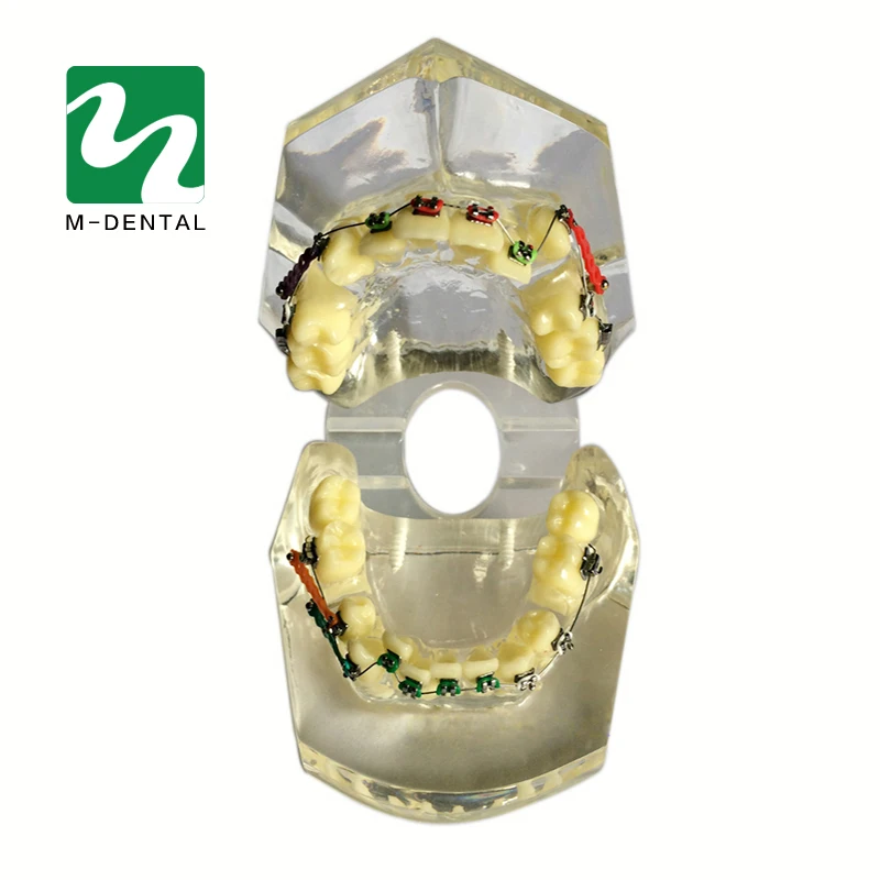 1 шт. Стоматологическая Ортодонтическая модель для обучения прозрачная с