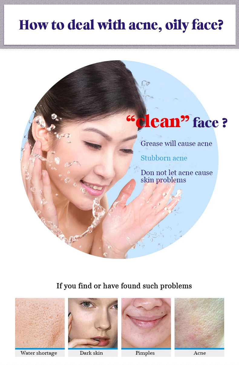 BIOAQUA Управление масло для лечения акне Cleanser Clean пор увлажняющий угорь угревая