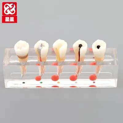 

tooth The roots Treatment Model Dental teaching model free shipping