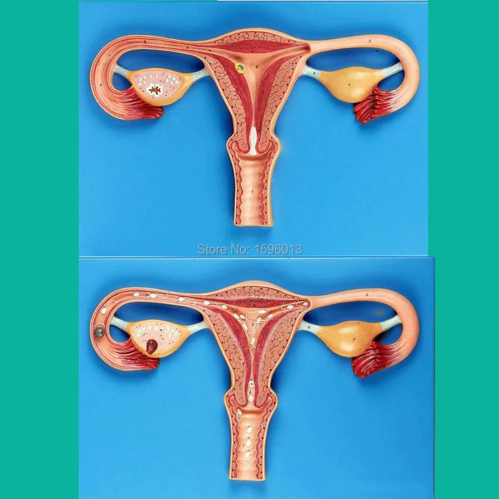 

Метод удобрения модель симулятора, модель процесса удобрения яиц