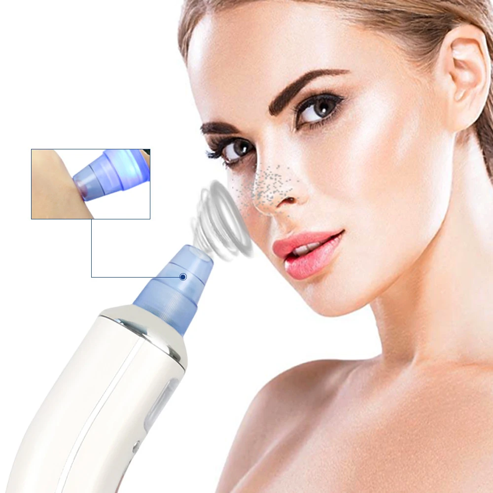 Лица очиститель пор Черноголовых RemovalUltrasonic вибрации лицо поры на носу Cleaner