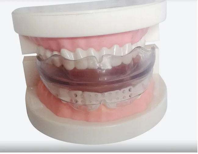 Зубные приборы невидимые ортодонтические скобы понижающие зубы антимолярные