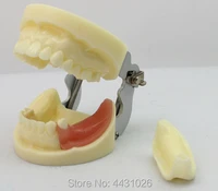 enovo oral cavity planting model dental surgery teaching model dental dentistry dental implant practice examination