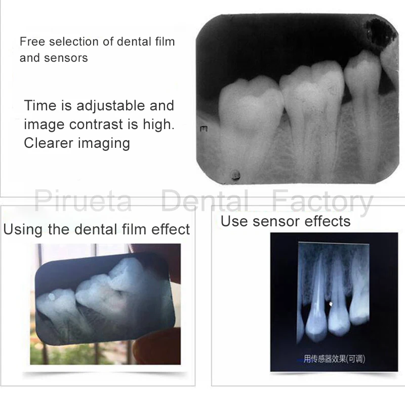 

High Quality Dental Portable X Ray Unit/High Frequency Portable Dental X-Ray Machine/Dental Imaging System 110V-220V