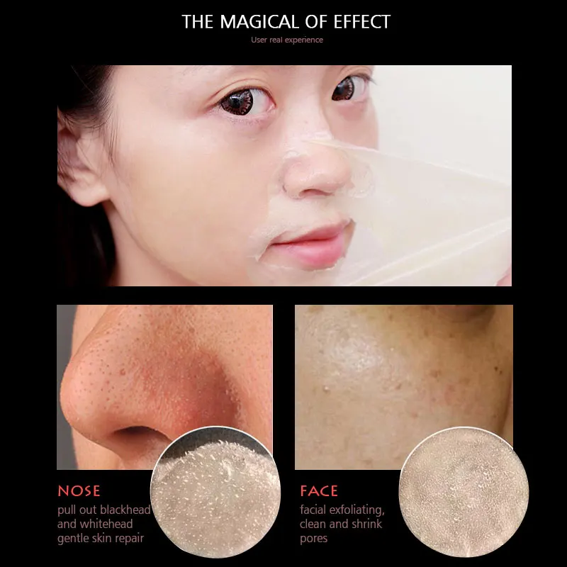 ARTISCARE средство для удаления угрей маска лица уход за кожей полоска пор нос черная