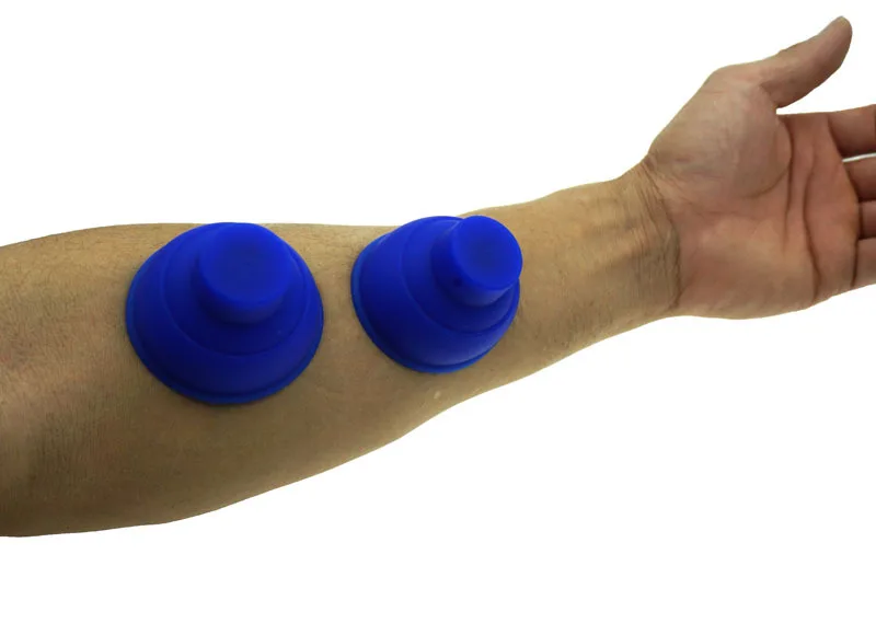 Электрический шок Вакуумная присоска всего тела медицинский массажер