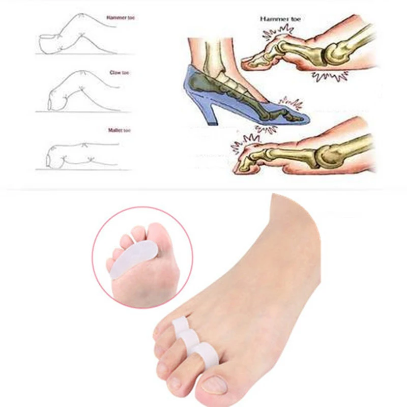 1 пара силиконовых гелевых молотков разделитель для коррекции пальцев ног