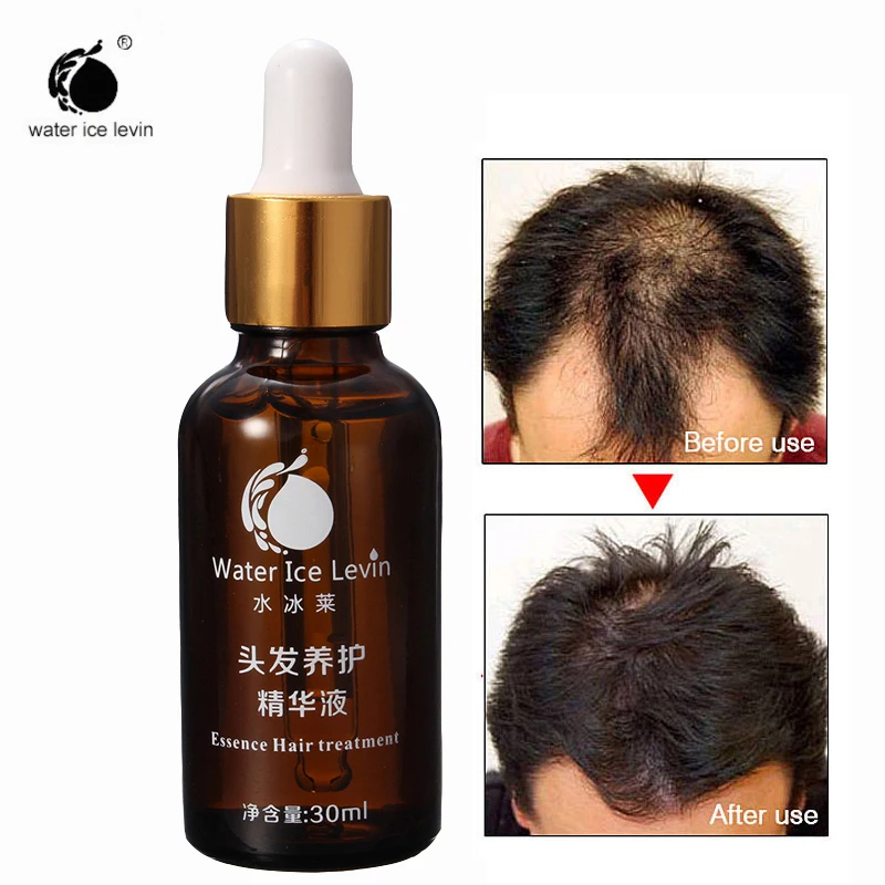 

Fast Powerful Hair Growth Essence Products Essential Oil Liquid Treatment Repair Hair Root Preventing Hair Loss Hair Care 30ml