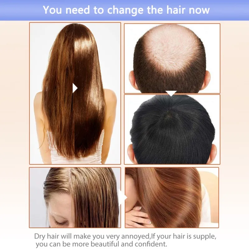 20 мл эссенция для роста волос средство лечения выпадения продукты густых