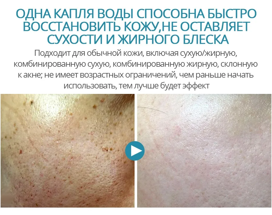 Яркая Гламурная Гиалуроновая кислота Сыворотка увлажняющая крем для лица с эфирными маслами сужает поры уход за кожей Ремонт Отбеливание антивозрастной