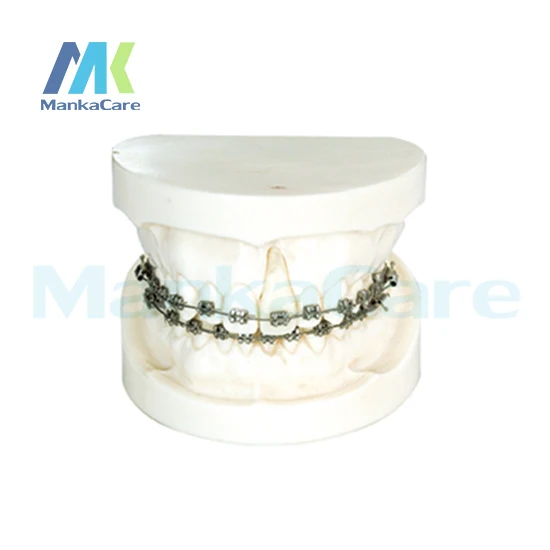Manka Care - Ortho With Edgewise Bracket/Produced by imported resins, without articulator Oral Model Teeth Tooth Model